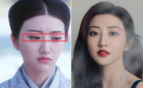 景甜双眼皮是怎么回事 景甜承认整容失败变成悲伤蛙详情介绍