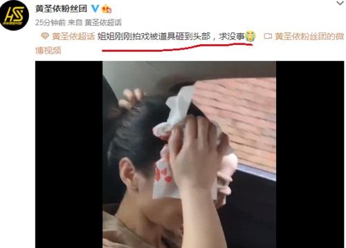 黄圣依拍戏头部受伤,黄圣依最新消息