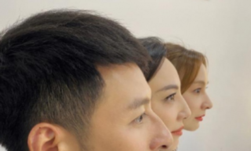 李维嘉,郑希怡,吴昕,李维嘉吴昕郑希怡同款鼻子
