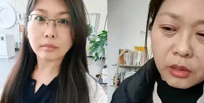 42岁女子20天断崖式衰老,网友:忘开美颜了