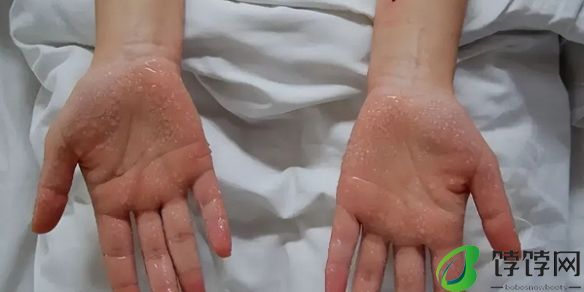 千万别再误解了 容易晒伤 高温天 穿得越少越凉快吗?