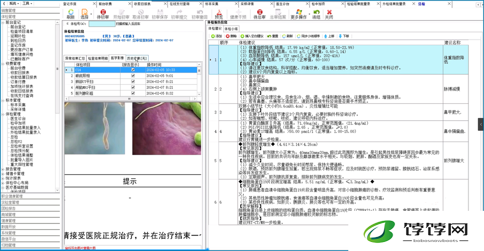 100%胸片曝光率软件：精准高效的医疗助手