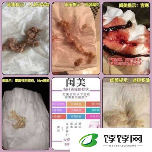 月月我这是帮你排阴毒：千万别信