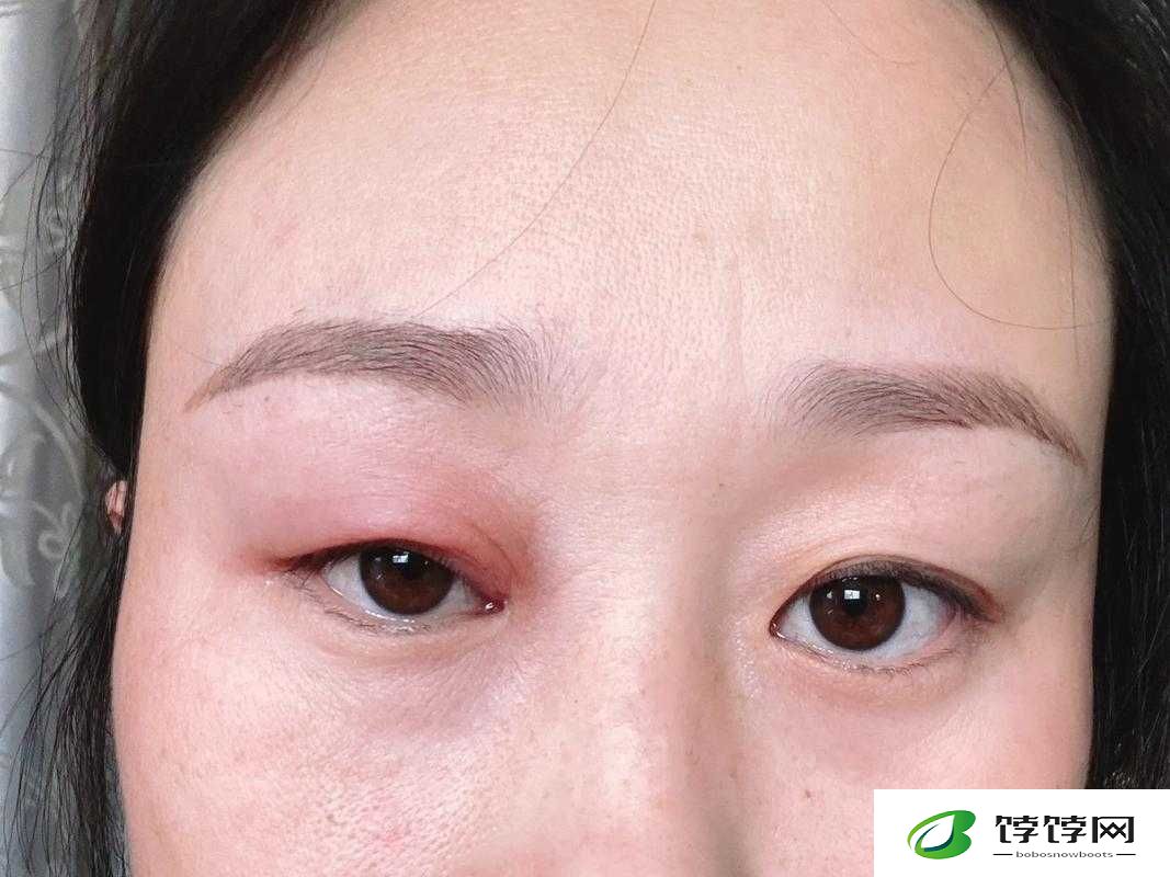 上下两张嘴都肿了：原因何在