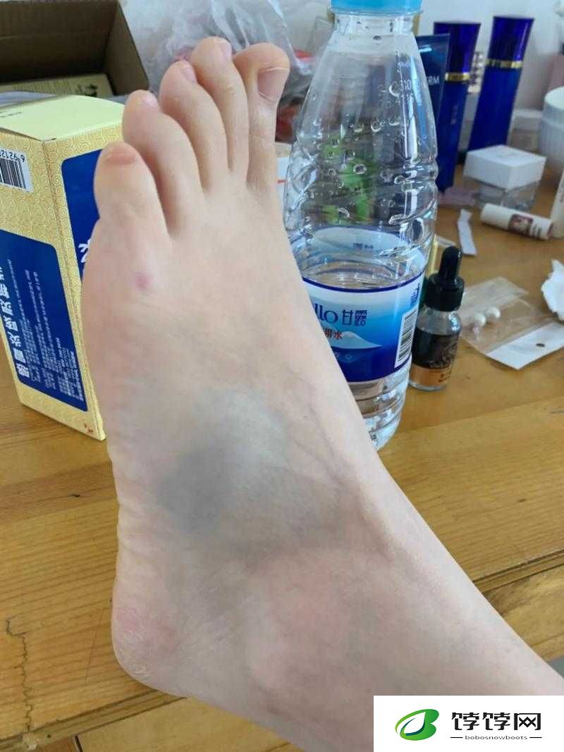 红肿疼痛小缝不能合拢：探寻背后的健康隐忧