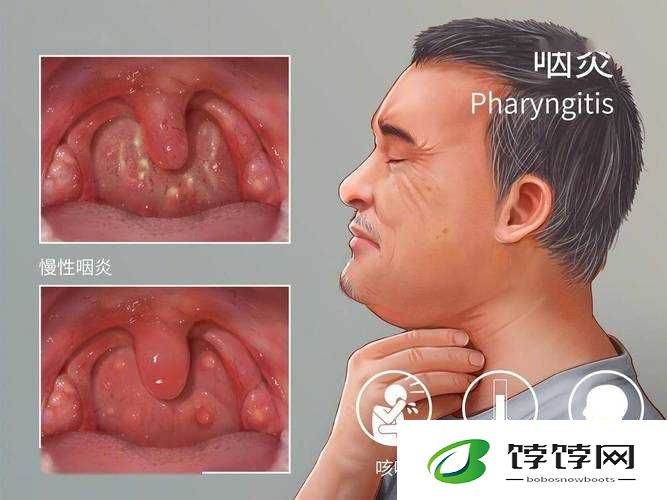 每次跟男朋友口完嗓子都发炎：原因究竟为何