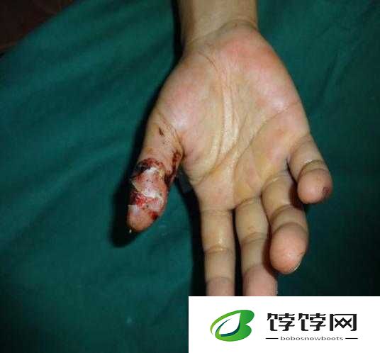 手指划入缝隙挖水：探索绝境中的求生奇迹