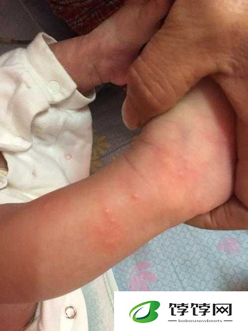 宝贝把腿张得大一点就不痛了：这样真的可以吗