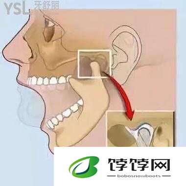 策划：上下两张嘴都肿了的应对之策